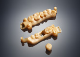 Hartgipsmodelle von Kronen und Brücken, gefertigt aus MED690 einem auf Objet30 Dental Prime 3D-Drucker